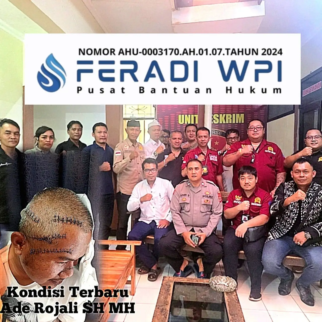 Advokat FERADI WPI Ade Rojali Alami Luka Berat Akibat Penganiayaan, TIM HUKUM Meminta Penanganan Serius Pihak Polsek Majalaya